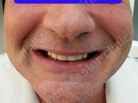 Mr.Peter 1